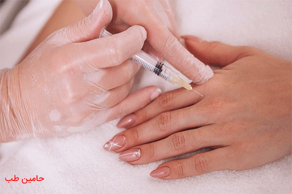 معرفی روش‌های مؤثر برای جوانسازی پوست دست